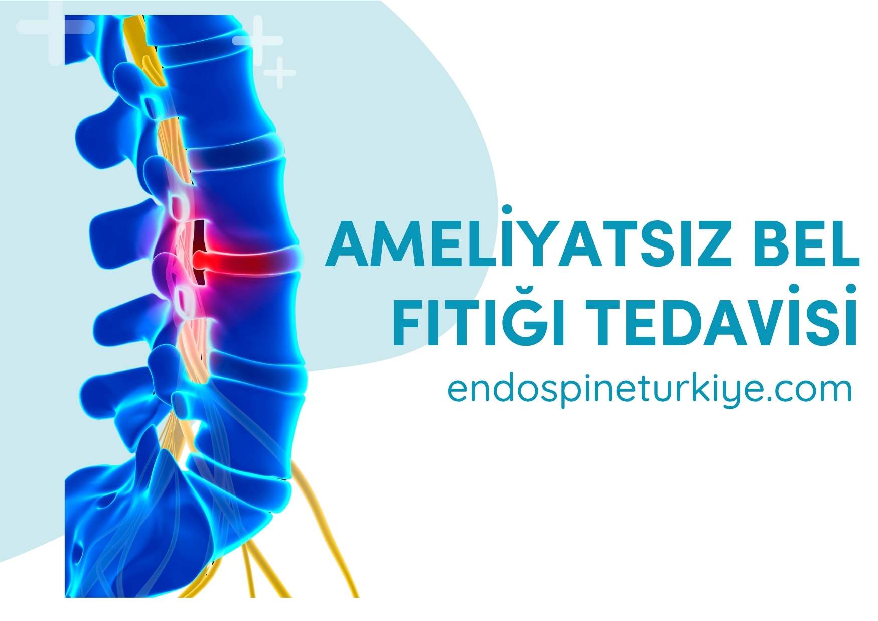 Ameliyatsız bel fıtığı tedavisi - Fizik tedavi seansı - 2025